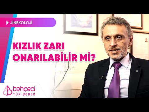 Kızlık zarı onarılabilir mi ? – Doç. Dr. Bora Cengiz