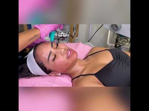 Microchanneling With NanoStamp 360!