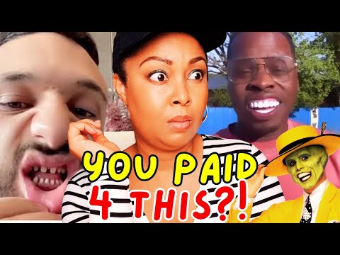 They WANTED celebrity smiles. They got THIS instead! TURKEY teeth gone wrong! | This Bahamian Gyal