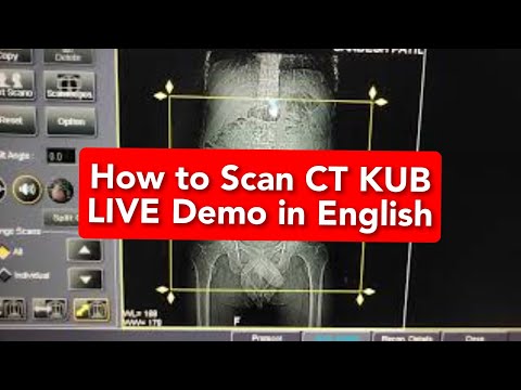 CT KUB protocol, positioning and planning on Toshiba 16 Slice | Live Demo in ENGLISH
