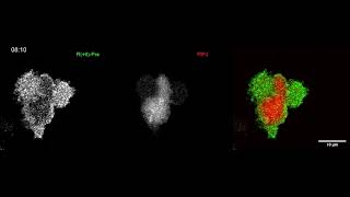 Newswise:Video Embedded how-does-a-cell-move-pull-the-plug-on-the-electrical-charge-on-the-inner-side-of-its-membrane-say-scientists