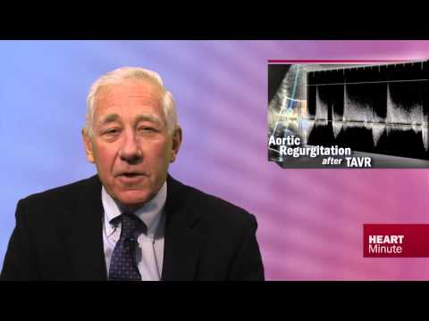 Heart Minute | AR Post TAVR