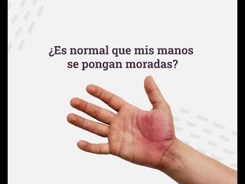 ¿Es normal que mis manos se pongan moradas?- Aclarando dudas.