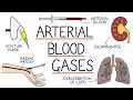Understanding Arterial Blood Gases