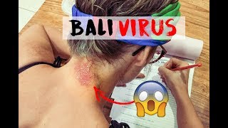 CATCHING NASTY SKIN VIRUS IN BALI FOR HER BIRTHDAY!