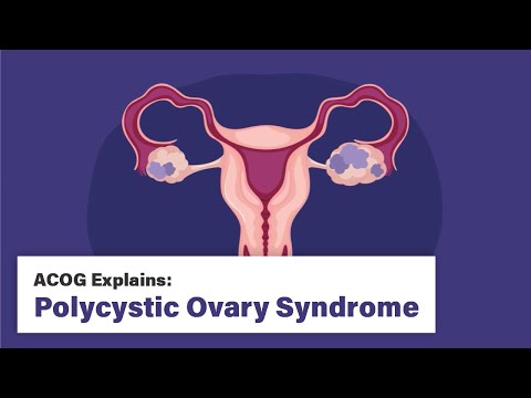 ACOG Explains: Polycystic Ovary Syndrome