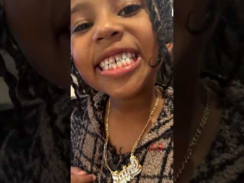 Kim Kardashian Son Saint West Shows off LV logo on his Front Tooth