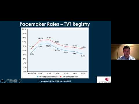Challenges in Evaluation and Management of Patients with Aortic Stenosis