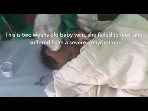 Help a Malnourished Child with Whisper's Hospital