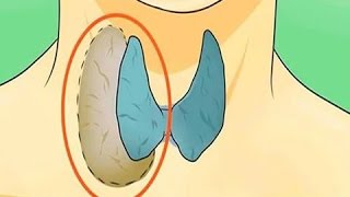 Los Médicos No Lo Dicen  ¡Aprende A Sanar Tus Tiroides Naturalmente! | Mejor Salud