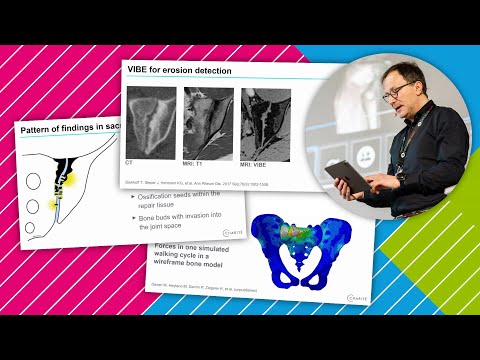 Advanced imaging of spondyloarthropathies*: What is new? // *aka Spondyloarthritis