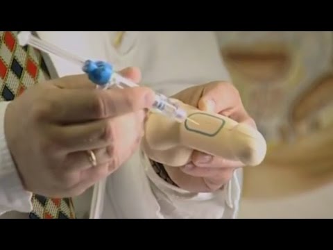 Medikamente für eitrige Prostatitis Saransk Prostatamassage