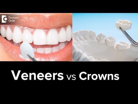  Difference between Veneers and Crowns
