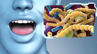 О каких БОЛЕЗНЯХ ГОВОРИТ ЗАПАХ изо рта