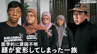 顔の形が変わってしまった特殊な一族の実態がとんでもなかった