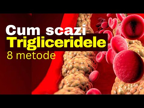 How to Lower Triglycerides: 8 Methods