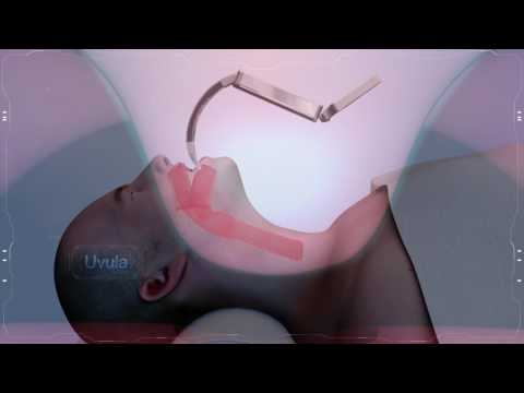 How does Tuoren VLM432 Video Laryngoscope work?