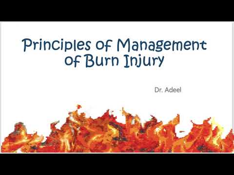 Burns management | General Surgery