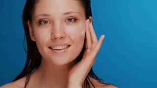 Top 7 Best Anti Acne Creams for All Skin Types – Proven Results!