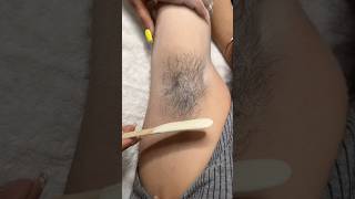 How to remove Underarm Thick Hair with Waxing #makeoverbyanita002 #waxing #hydrafacialmachine #yt