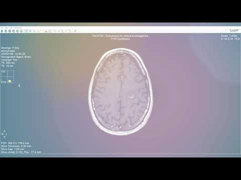 Adjusting time parameters post scan with SyMRI