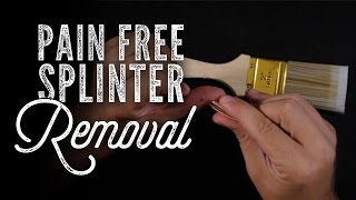How To Painlessly Remove Splinters From Your Skin