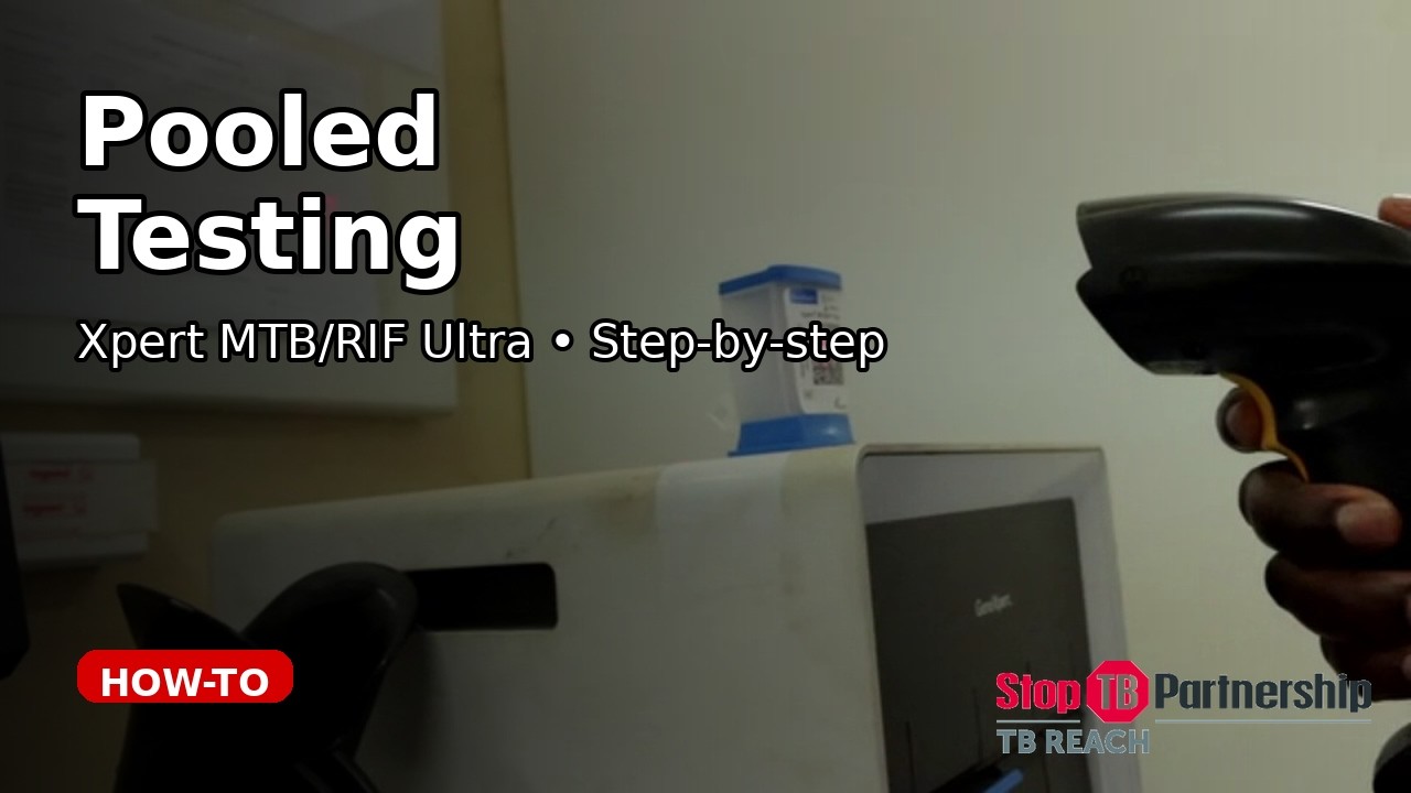 How to Perform Pooled Testing for TB