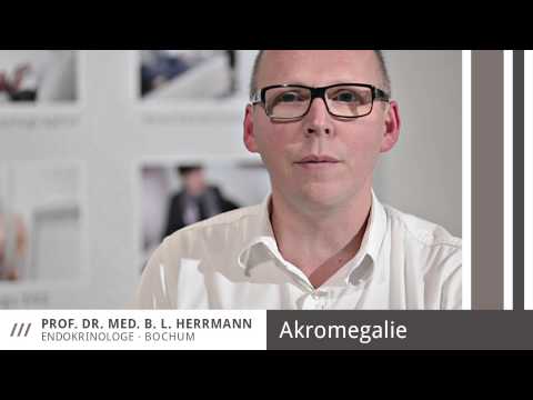 Akromegalie /// Prof. Dr. med. Herrmann, Endokrinologe Bochum