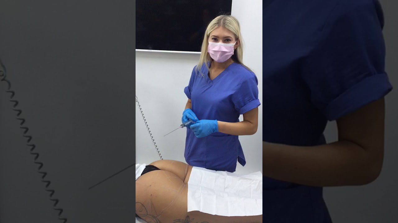 Brazillian Butt Lift Course 9 - Professional Aesthetics Academy