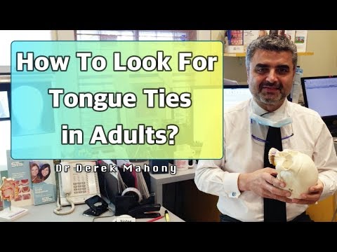 How To Look For Tongue Ties In Adults