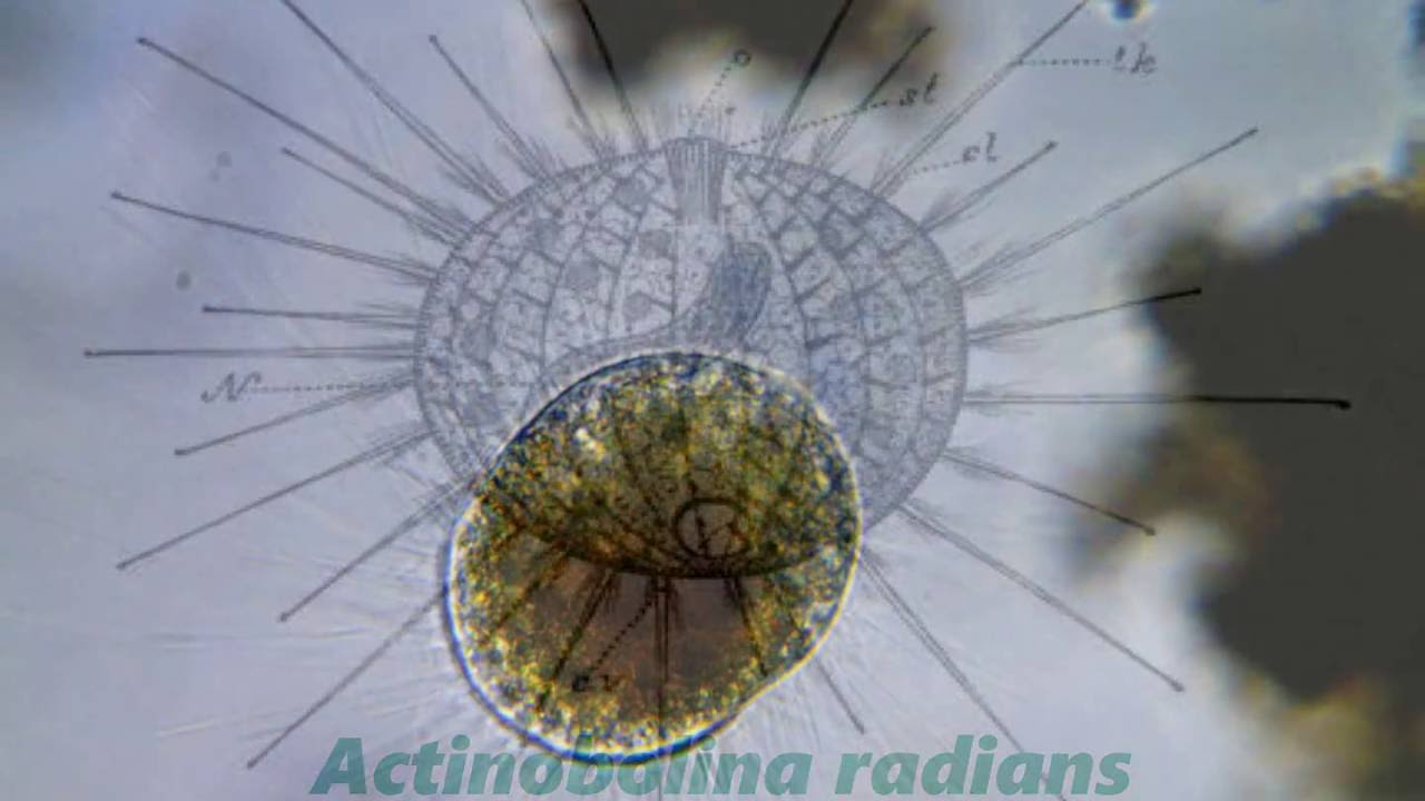 <em>Actinobolina radians</em> -- A ciliate that resembles a heliozoan