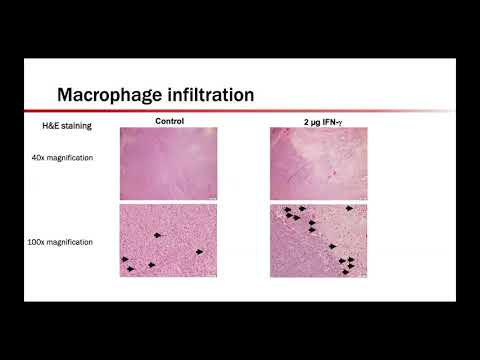 IFN-Gamma Analogues: The Next Frontier in Immunotherapy