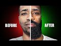 Watch This If You Have A Patchy Beard Science Based