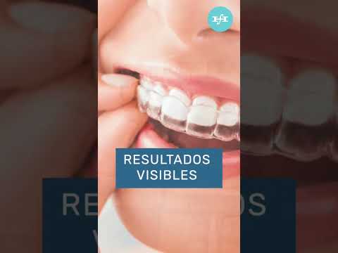 Invisalign, alineadores transparentes