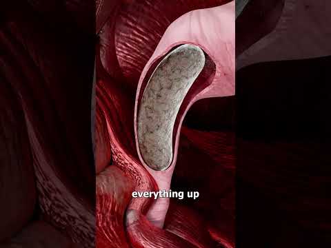 How Squatty Potties Are Better For Pooping 🤔