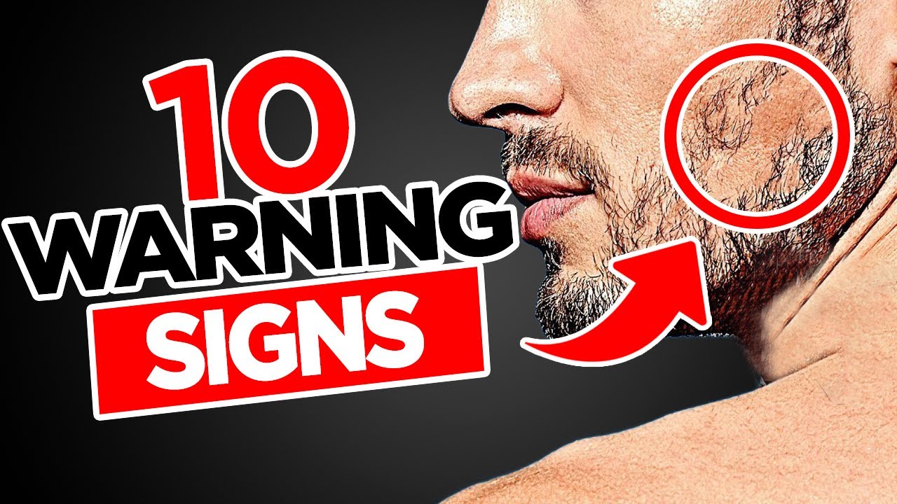 10 Low Testosterone Symptoms (SERIOUS Signs YOU Need To Watch For!)
