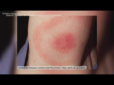 Verify: The Lyme Disease Myths