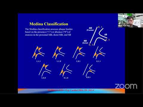Step by step manual for planning and management of Bifurcation lesion