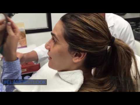 Septorhinoplasty, Rhinoplasty, Septoplasty & Ethnic Rhinoplasty Reveal - #ElamFirstLook