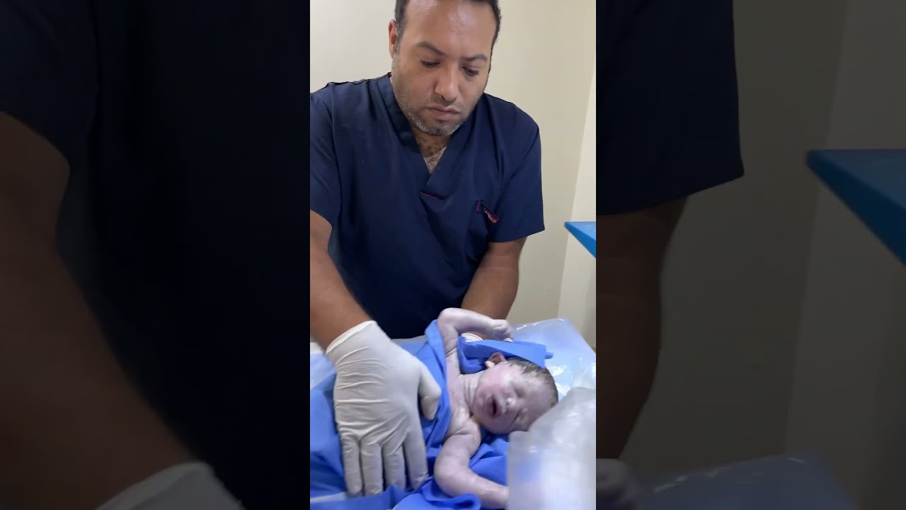 before and after resuscitation #baby