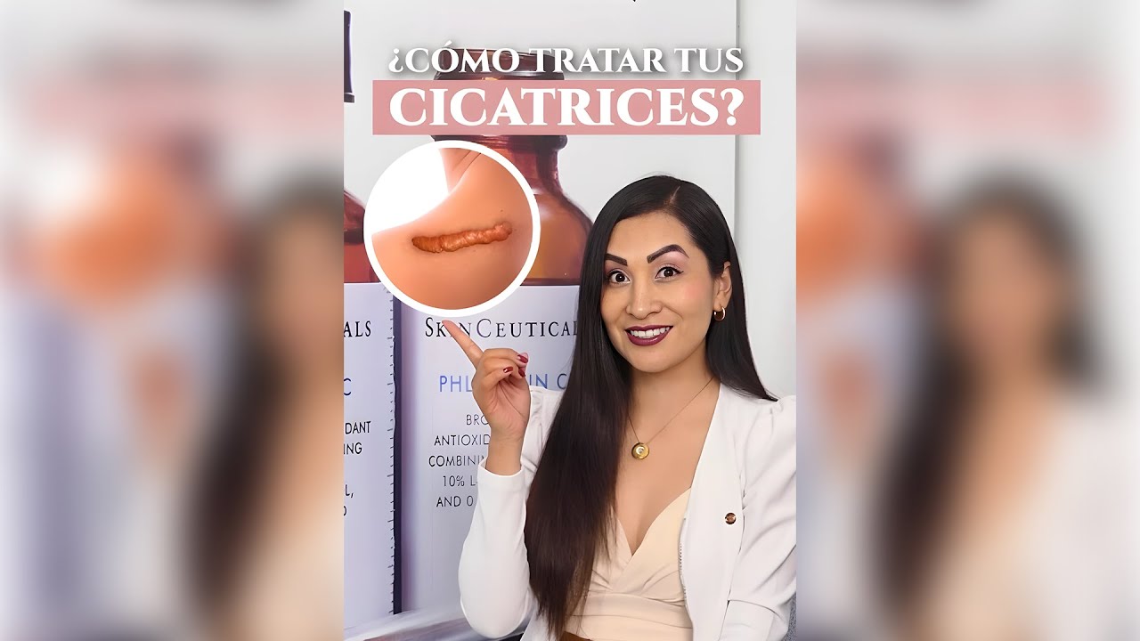 🤔¿Cómo tratar tus cicatrices? - Dra. Gisela Pilar Aire Farfán