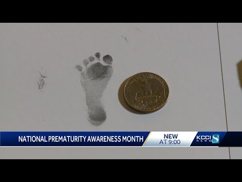 Family of boy born at 28 weeks shares story of hope