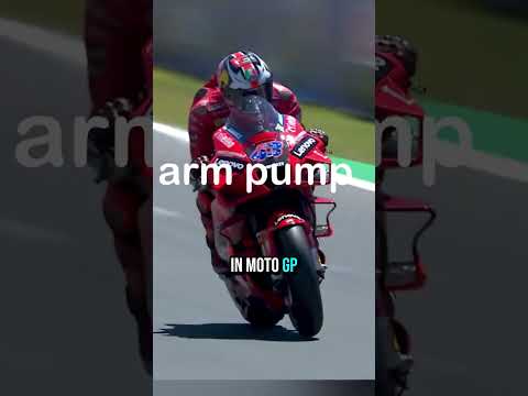 Nearly Every MotoGP Rider Has This Scar… Here’s Why 🤯