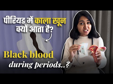 Black color period blood do this! Black period blood do this 🩸| Gynae talk