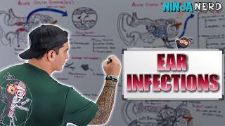 Ear Infections | Clinical Medicine