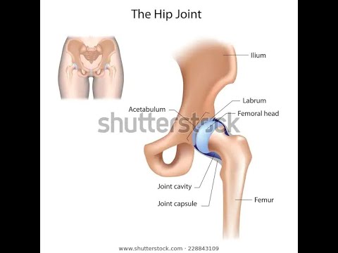 Medial Approach to the Hip.