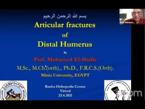 Articular Fractures of Distal Humerus ( Prof. Mohamed El-Shafie )