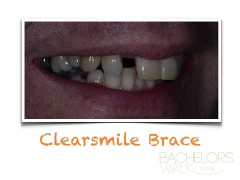 How much would a new smile mean to you?