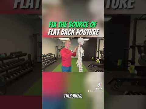 Fix the SOURCE of Flat Back Posture