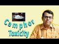 Camphor Toxicity in Children